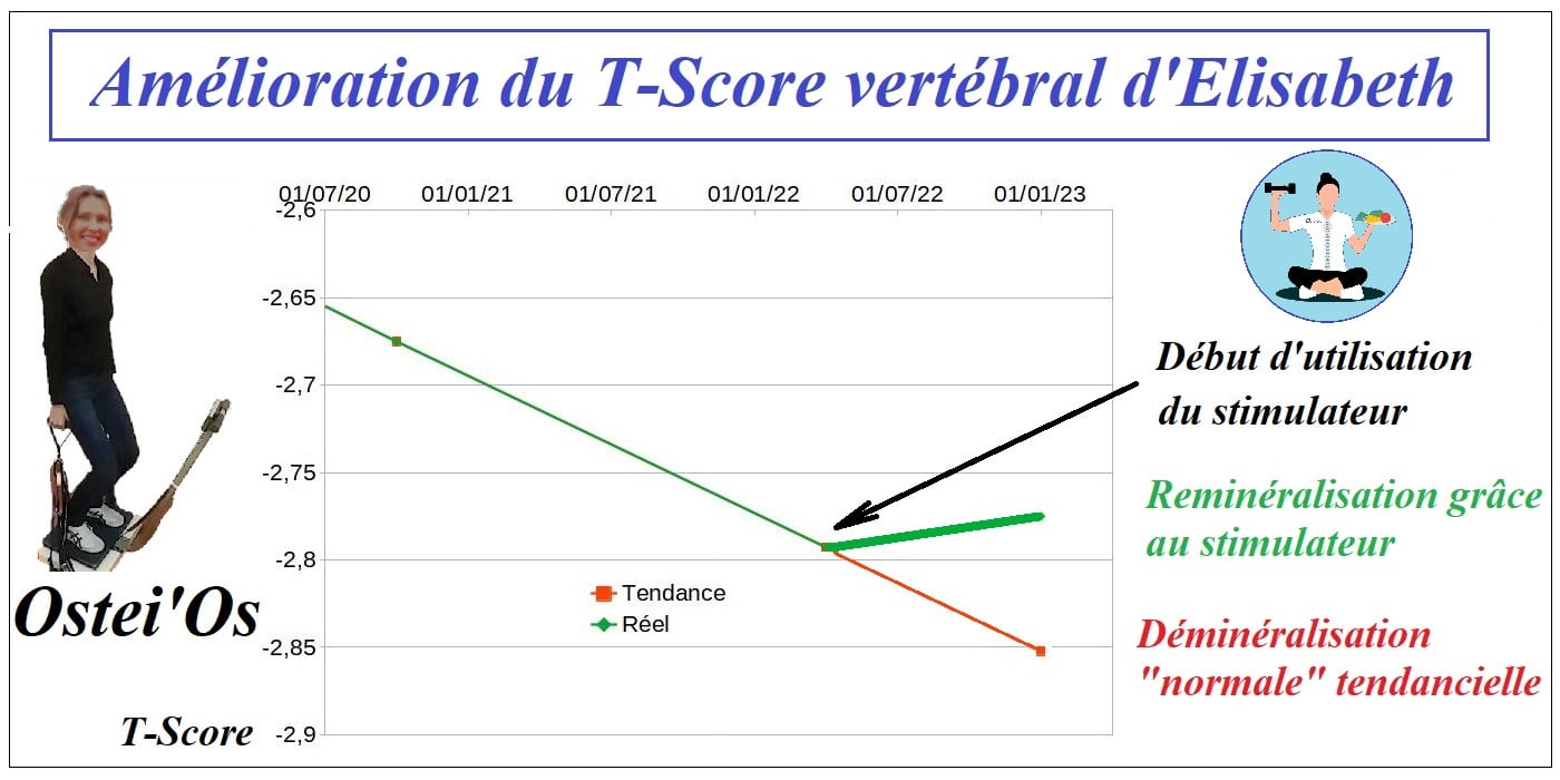 Ost oporose Comment lisabeth Am liore R ellement Son T Score