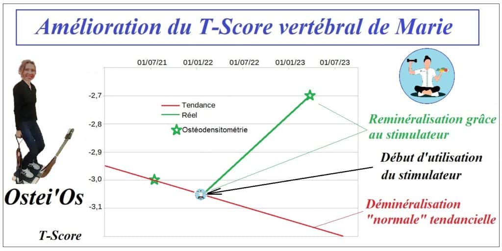 Traitement naturel pour inverser l'ostéoporose vertébrale (rachis lombaire) - Ostei'Os