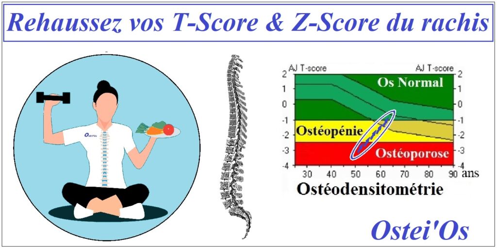 am-liorez-vos-t-score-vert-bral-z-score-du-rachis-lombaire